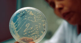 Bacteria sample inside petri dish for biotechnology study