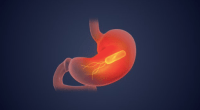 IARC - @IARCWHO Twitter