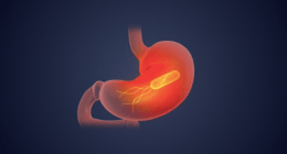 IARC - @IARCWHO Twitter